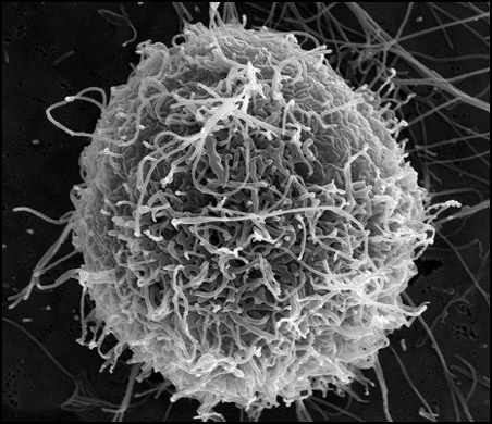 ebola_virus_particles-10-23-14